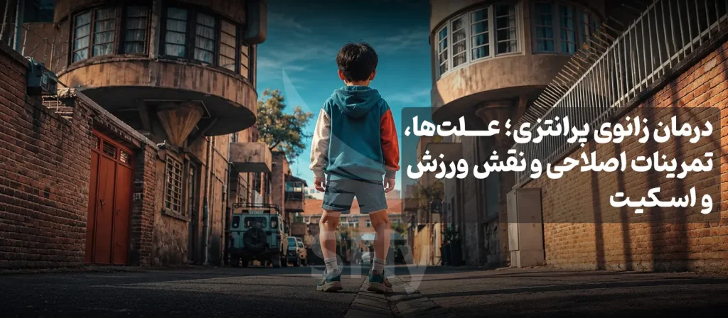 درمان زانوی پرانتزی؛ علت‌ها، تمرینات اصلاحی و نقش ورزش و اسکیت